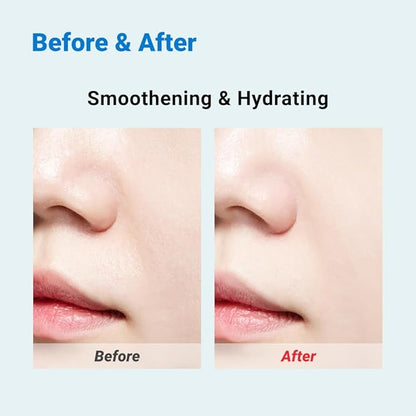 Real Barrier Aqua Soothing Ampoule Pad, 70 Pads l Hyaluronic Acid Facial Serum | Redness Relief for Sensitive Skin | Facial Moisturizer for Dry Skin| Calming Chamomile Extract| Korean Skincare