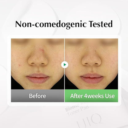 UIQ Biome Remedy Toner Pads, Dual-Textured Facial Pad for Hydrating, Moisturizing, Calming, Pore Care, Non Comedogenic, Daily Toner Pads for Soothing Skin 6.08 fl. oz., 70 Sheets