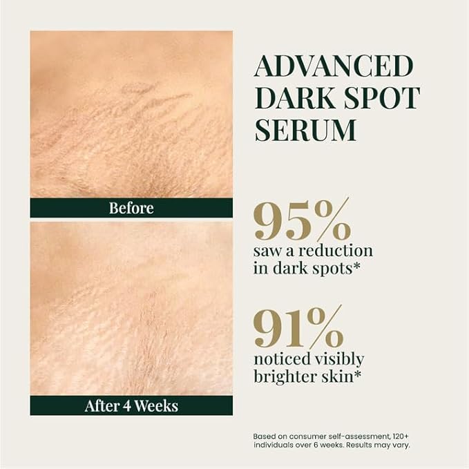 E'Luxxe Advanced Dark Spot Serum – Triple Vitamin C, Tranexamic Acid & Niacinamide with Papaya & Cica - Hyperpigmentation & Dark Scar Treatment for Face & Body, Non-Comedogenic, Fragrance-Free (50ml)