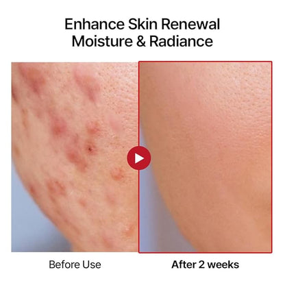 Swanicoco PDRN Hydrating Repair Ampoule Serum Powerful Anti Aging Face and Neck for Skin Turnover Skin Regeneration Wound Healing Korean Skincare, Stocking Stuffer 30ml 1Fl Oz