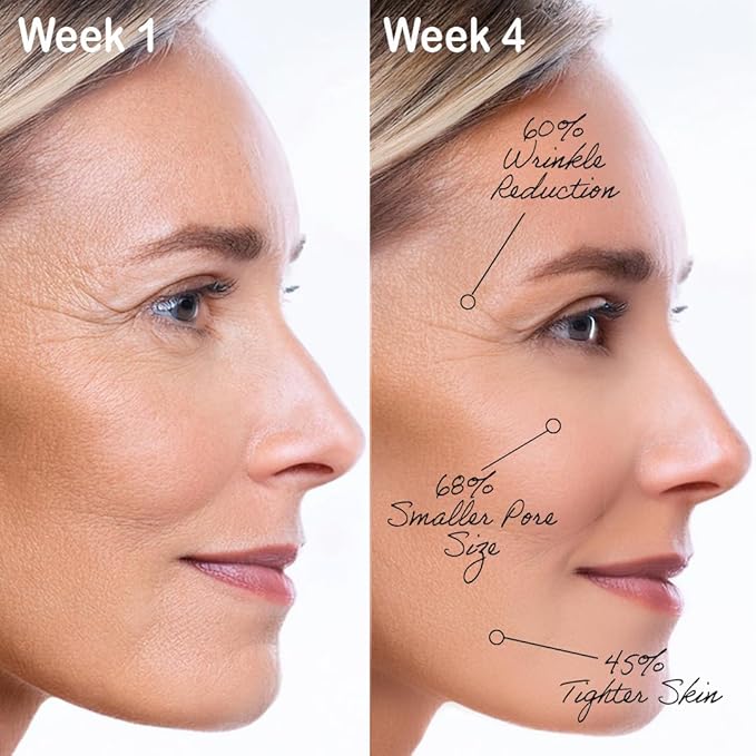 Face and Neck Anti-Aging and Anti Wrinkle For Women | Hydrating & Firming Skincare for Women | Anti-Aging Wrinkle Cream for Face and Neck with Hyaluronic Acid, Collagen, Squalene, Vitamin C, A & E