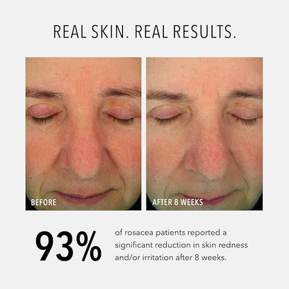 Hydropeptide Soothing Serum, Moisturizing & Anti-Aging Peptide Facial Serum, 1 Ounce