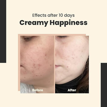 Creamy Happiness - Advanced Retinal Emulsion 0.1% Encapsulated for Stability - Smoothes & Firms – Deep Hydration – 30 ml/Net 1.01 Fl. Oz