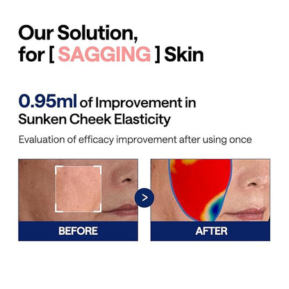 Mediheal Retinol Collagen Under Eye Patches & Collagen Ampoule Pad for Daily Skin Elasticity Care