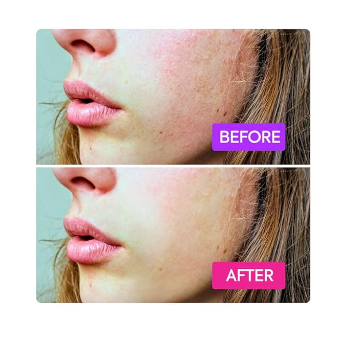 IYKYK By Makari Probiotics Booster for Skin Barrier Support – Soothing Face & Neck Hydration Serum with Vitamin F, Omega 3 & 6, & Squalane, Vegan, Fragrance Free, Dermatologist Tested Skincare