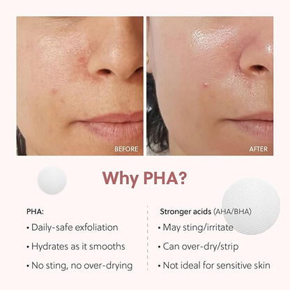 QUIA Dual-Action Toner Pads – Exfoliate and Hydrate Pores in One Step – Soothing PHA Formula for Sensitive Skin – Reduces Blackheads and Blemishes- 70 Textured Pads – Korean Skincare