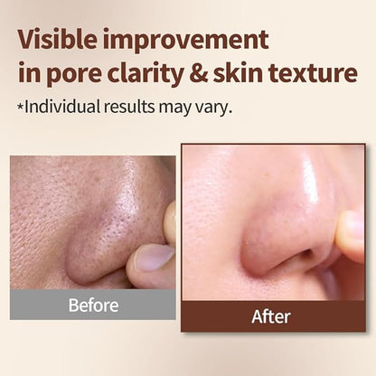 1.618 Volcanic Clay Korean Face Mask Fast-Drying Smooth Mud Mask with Tea Tree Care for Blackheads and Pores Pore Minimizer Skin Care Reducer