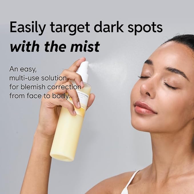 5% Niacinamide Milky Toner with Kojic Acid & Turmeric – Dark Spot Care, Skin Tone Improvement, Gentle Hydration for Face & Body, 200ml (6.76 fl oz)