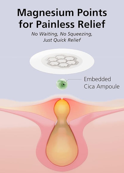 EasyDerm Quick Calming Magnesium Patches – 30 Patches Bulk Pack, Individually Wrapped Acne Care, Includes Tweezers & Ampoule, Korean Skincare, Made by Daewoong Pharmaceutical