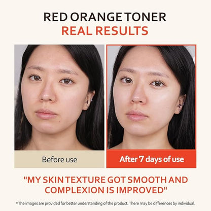 T'else Red Orange Niacinamide Toner 150ml, 5.2 Fl.oz, Tone Up Vitalizing Facial Essence, Smoothening Skin Texture Watery Toner with Exfoliation, PHA Care with Vitamin C & Panthenol, Korean Skin Care