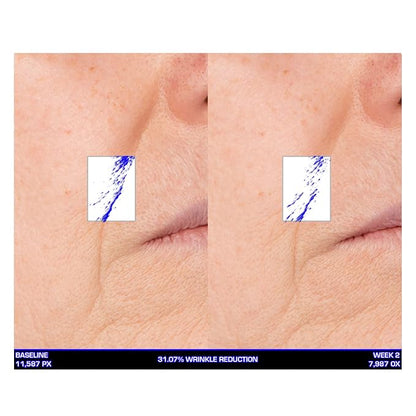 Serious Skincare Ultra-Mare Pure Marine Infusion Facial Serum - Encourages Collagen Production, Cell Turnover and Plumper Skin - Niacinamide - Acid Free - Concentrated 2 oz.