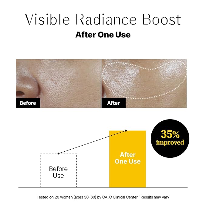 Glow Aurora Serum – Lightweight Korean Glow Drops for Face with Niacinamide, Hyaluronic Acid & Lutein, Face Glow Serum for a Dewy, Healthy-Looking Complexion, 1.01 fl oz / 30ml