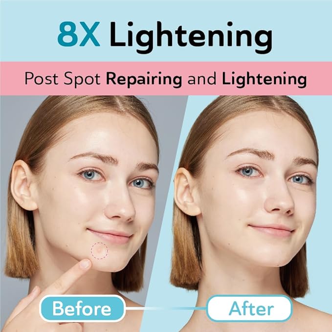 DERMA ANGEL Dark Spot Patches Blemish Patches with Hydrocolloid, TXA & CICA for Active Acne & Post-Inflammatory Dark Spots - Day and Night Use - UPGRADED (Post Acne - 132 Count - 2 Size)