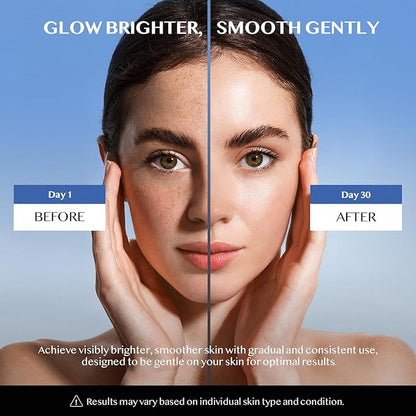 Dark Spot Remover for Face & Body – Dark Spot Corrector for Face - Hyperpigmentation, Age Spot, Sun Spot, Melasma & Freckles – Brightening & Even Skin Tone Treatment (1.7 Fl Oz)