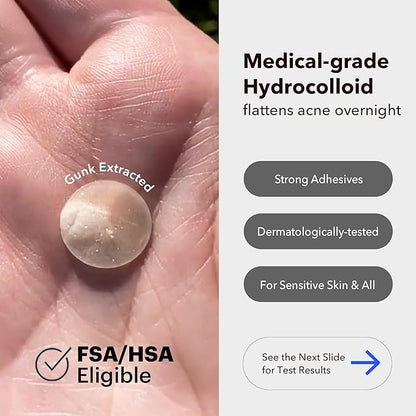 AVARELLE Pimple Patches for Face | Hydrocolloid Acne Patches for Covering Blemishes | FSA HSA Store Eligible Zit Patches with Tea Tree, Calendula, & Cica | (10-14 mm, 300 Count) Bulk Pack