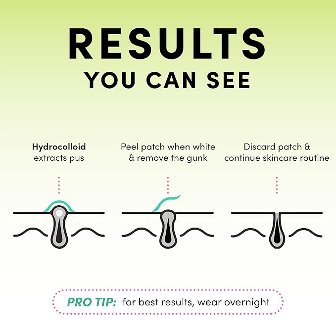 Dots for Spots Pimple Patches For Face - Fast Acting, Translucent Hydrocolloid Zit Patches that Unclog Pores - Korean Skincare - Vegan, Cruelty Free - (120 count)