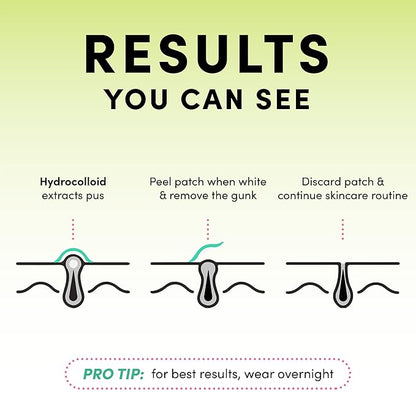 Dots for Spots Pimple Patches For Face - Fast Acting, Translucent Hydrocolloid Zit Patches that Unclog Pores - Korean Skincare - Vegan, Cruelty Free - (120 count)