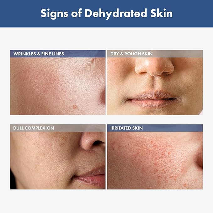 TOSOWOONG Hyaluronic Acid 3% Serum, 30,030ppm Sodium Hyaluronic Acid, Hydration, Moisture Boosting Facial Serum for Fine Lines & Wrinkles, Plump & Repair Dry Skin, Korean Skin Care, 30ml, 1.01 fl.oz.