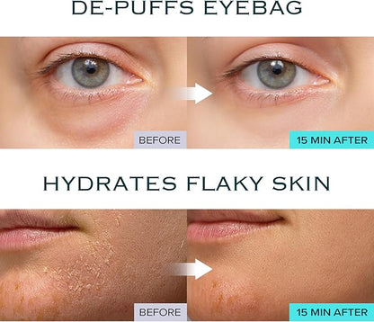 Ice Sorbet Toner Pads | Skin Prep Wipes for Puffiness, Under Eye Bags & Instant Face Lift | Gel Pads for Sunburn Relief & After Sun with 30% Glacial Water & Caffeine | Pack of 3 (180 Count)