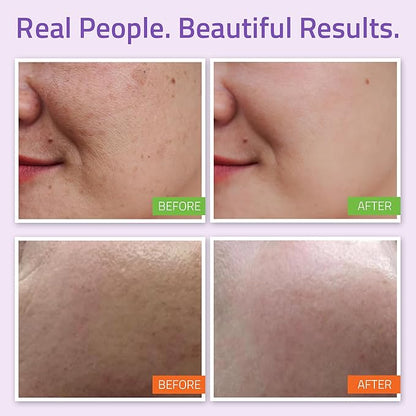 YEOUTH Skin Care Set: Hyaluronic Acid Serum, Vitamin C Serum, Face Cleanser, Toner, Under Eye Gel, Face Cream, 6-Piece Skincare Kit For Women & Men