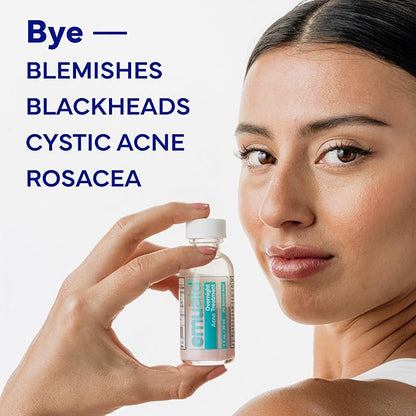 EMUAID Overnight Acne Treatment, Gentle Fast-Acting Solution with Salicylic Acid for Adults and Teens, Clears Stubborn Pimples, Cystic Acne, Blackheads, Rosacea, and Hormonal Breakouts, 1oz