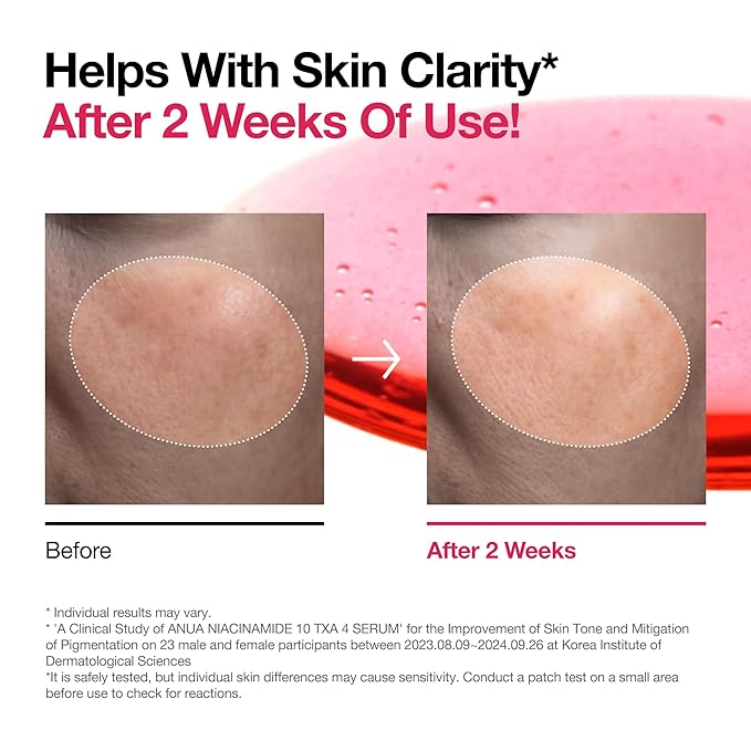 ANUA Niacinamide 10 + TXA 4 Serum, Hyaluronic Acid, Tranexamic acid, Facial Serum for Glass Skin, Clarifying, Radiant Complexion with Natural Color, Korean Skin Care (30ml /1.01 fl.oz)