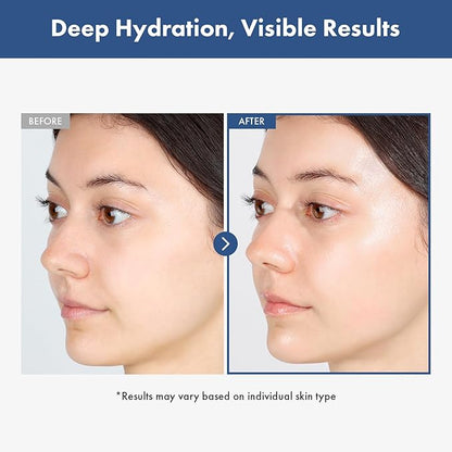 TOSOWOONG Hyaluronic Acid 3% Serum, 30,030ppm Sodium Hyaluronic Acid, Hydration, Moisture Boosting Facial Serum for Fine Lines & Wrinkles, Plump & Repair Dry Skin, Korean Skin Care, 30ml, 1.01 fl.oz.