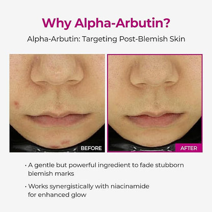 Dr.Melaxin Cemenrete Picotonic Shot Calcium Ampoule for Even Skin Tone & Skin Clarity, 1.01 fl.oz.