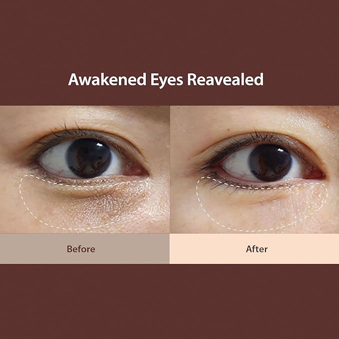 BLITHE Caffeine Eye Serum for Dark Circles and Puffiness, Plant-Based Retinol, Bakuchiol, Niacinamide, Sodium Ascorbyl Phosphate 0.67 Fl Oz