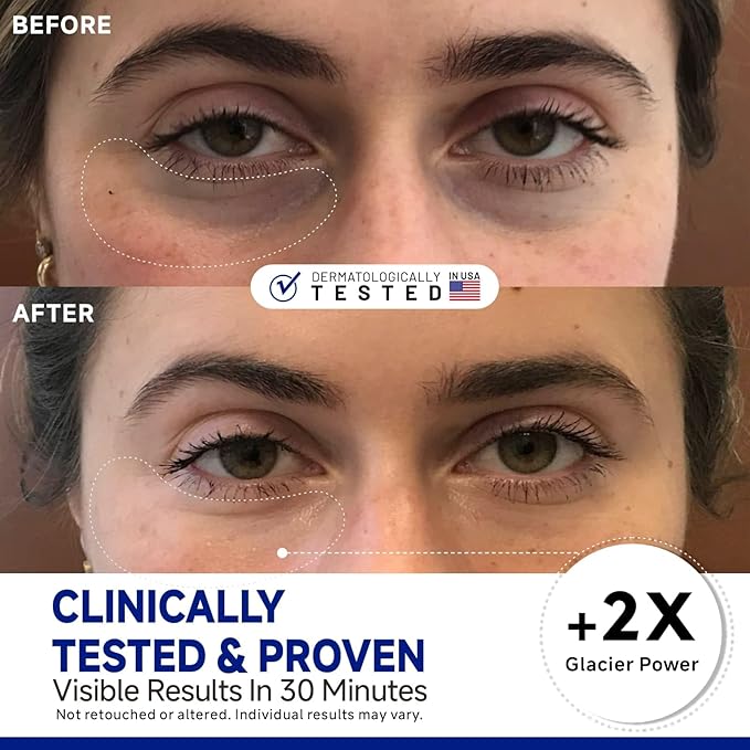 Peptide Cooling Under Eye Patches, Soothing Eye Patches Instant Reduces Dark Circles and Puffiness, Calming Under Eye Mask with Glacial Water for Bags Treatment, 24 Pairs