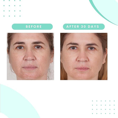 Serious Skincare Glycolic Acid Serum & Face Moisturizer Cream, Facial Renewal Skin Care Set, Exfoliating, Hydrating, Refine Texture, Lines, Pores, Discoloration, Skin Balancing Blue Tansy - Anti-Aging