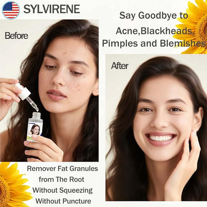 40 ml Milia Remover Treatment Serum for Eyes & Face, Milia Remover Essence, Milia Spot Remover for Clear Skin