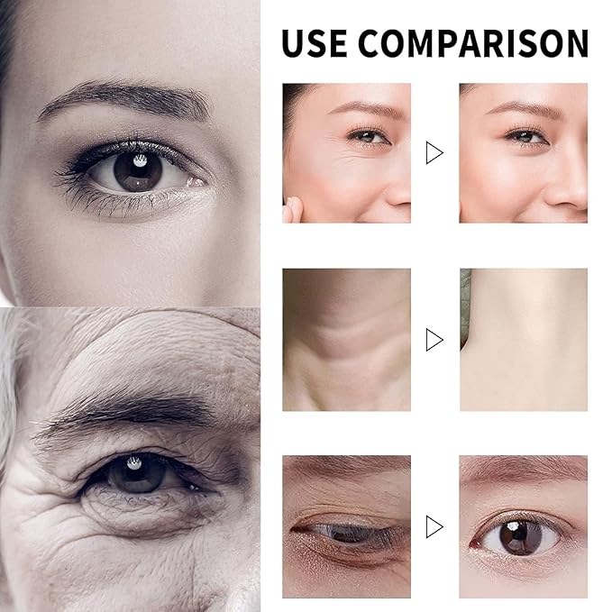 Qingling Face Cream, Qingling Wrinkle Removal Cream, Quinglin Polypeptide Tightening and Anti-Wrinkle Moisturizer, Face & Neck & Eye Lotion 3-In-1 (2)