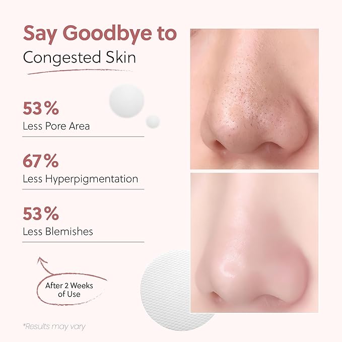 QUIA Dual-Action Toner Pads – Exfoliate and Hydrate Pores in One Step – Soothing PHA Formula for Sensitive Skin – Reduces Blackheads and Blemishes- 70 Textured Pads – Korean Skincare