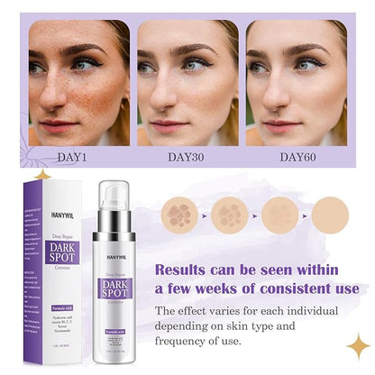 HANYWIL Dark Spot Remover for Face & Body Serum,Rapid Tone Repair Cream with Hyperpigmentation Treatment,Sun Spot, Age Spot & Melasma Remover,Dermatologist-Tested Brightening Retinol Serum (1.7 Fl Oz)