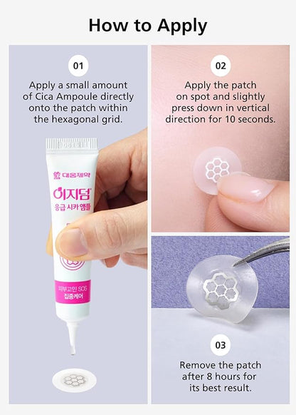 EasyDerm Quick Calming Magnesium Patches – 30 Patches Bulk Pack, Individually Wrapped Acne Care, Includes Tweezers & Ampoule, Korean Skincare, Made by Daewoong Pharmaceutical