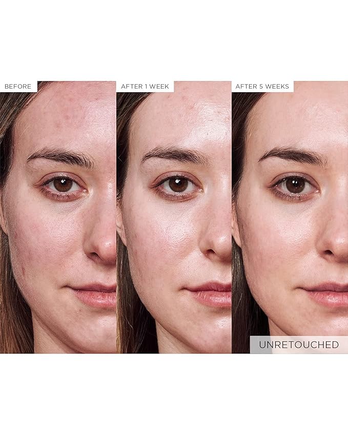 Glow Recipe Avocado Ceramide Serum - Soothing, Hydrating Face Serum for Women & Men, Redness Relief & Skin Barrier Repair - Lightweight, Milky Korean Skincare for Dry, Sensitive Skin (30 ml)