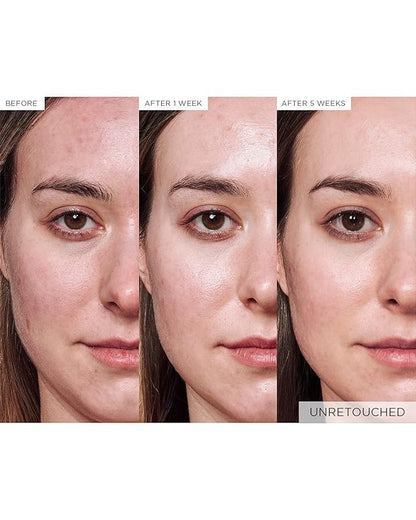 Glow Recipe Avocado Ceramide Serum - Soothing, Hydrating Face Serum for Women & Men, Redness Relief & Skin Barrier Repair - Lightweight, Milky Korean Skincare for Dry, Sensitive Skin (30 ml)