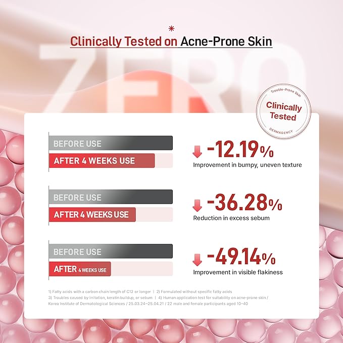 Zeroca 81 Korean Calming Serum for Acne-Prone & Oily Skin – Balances Oil-Water, Soothes Redness, Fades Post-Blemish Marks, Firms & Hydrates (1.01 fl.oz. 30 ml)