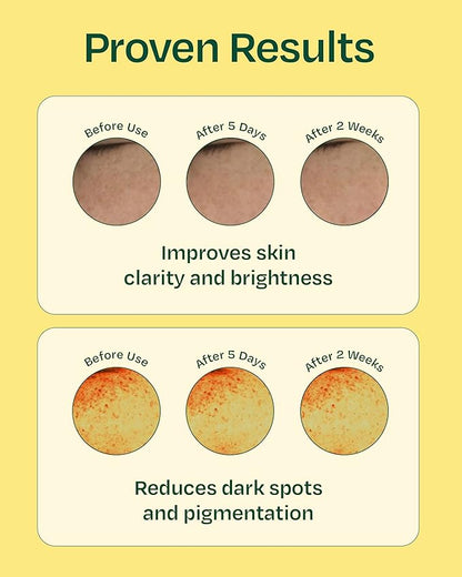 YADAH Green Tangerine Vita Serum 1.01 Fl oz 1-Pack - Hydrating, Revitalizing Serum with Vitamin C for Dull Skin and Radiant Complexion