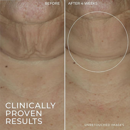 RoC Derm Correxion Retinol Firming Serum Stick with Antioxidants to Visibly Tighten and Firm Wrinkles and Laugh Lines 1.0 oz plus Retinol Eye Cream Packette