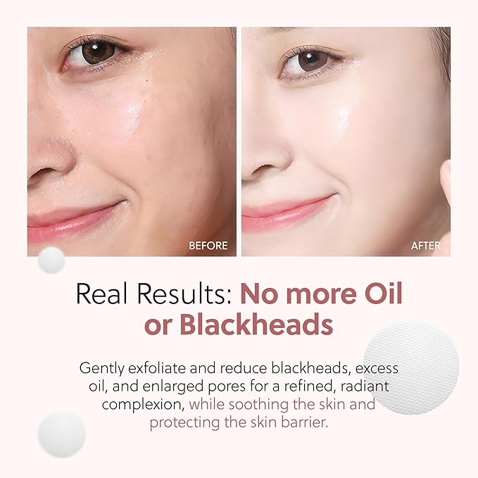 QUIA Dual-Action Toner Pads – Exfoliate and Hydrate Pores in One Step – Soothing PHA Formula for Sensitive Skin – Reduces Blackheads and Blemishes- 70 Textured Pads – Korean Skincare