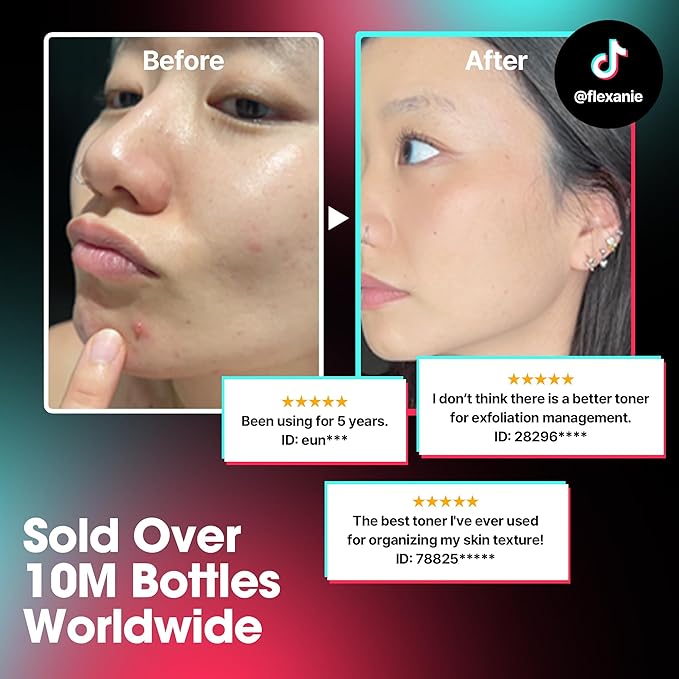 SOME BY MI AHA BHA PHA 30 Days Miracle Toner – Pack of 2 – Korean Salicylic Acid Exfoliating Face Toner for All Skin Types – Daily Pore Care & Oil Control with 2% Niacinamide – Korean Skin Care