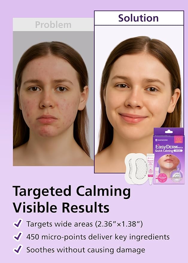 EasyDerm Quick Calming Magnesium Patches WIDE – 2 Packs / 4 XL Patches Total, Extra-Large Hydrocolloid Patch for Severe Acne, Soothing & Waterproof, Amazon Exclusive