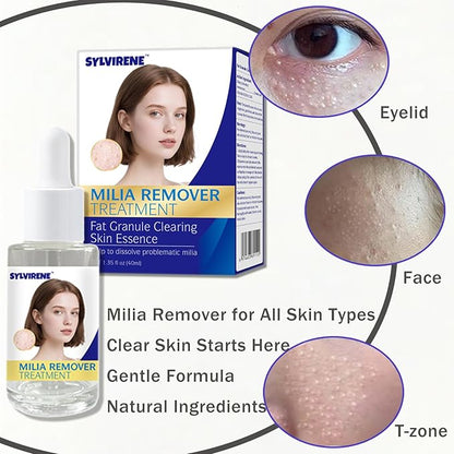 40 ml Milia Remover Treatment Serum for Eyes & Face, Milia Remover Essence, Milia Spot Remover for Clear Skin