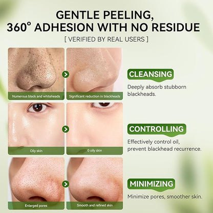 LANBENA Nose Pore Strips, 2pcs, 2% BHA(Salicylic Acid) Blackheads Remover Peel off Mask, Plants Pore Cleanser Purifying Face Mask, Unclog Pores, Oil Control, Upgraded 2.0 added Amazonian White Clay