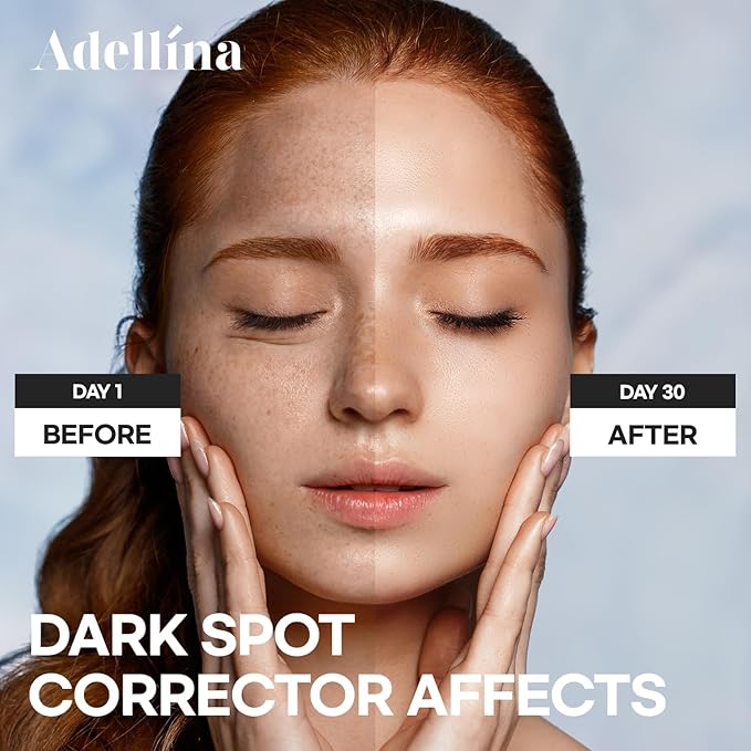 Dark Spot Remover for Face: Dark Spot Corrector for Sun Spots, Age Spots & Uneven Skin Tone - Vitamin C, Alpha Arbutin & Niacinamide for Even Skin Tone (1 Fl Oz)