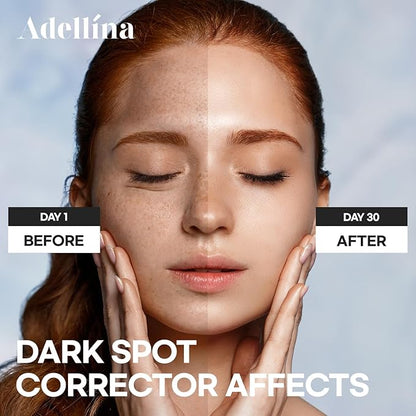 Dark Spot Remover for Face: Dark Spot Corrector for Sun Spots, Age Spots & Uneven Skin Tone - Vitamin C, Alpha Arbutin & Niacinamide for Even Skin Tone (1 Fl Oz)