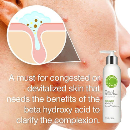CONTROL CORRECTIVE Salicylic Wash 2%, 6.7 Fl Oz - Excellent For Oily Or Acne-Prone Skin, Creamy/Gel Cleanser Helps Reduce And Control Breakouts Without Overstripping