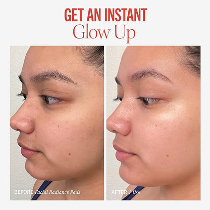 First Aid Beauty - Facial Radiance Pads with Glycolic & Lactic Acids, Daily Exfoliating Pads with AHA, Visibly Smaller Pores, Help Tone & Brighten Skin, One-Step Makeup Prep, Compostable, 60